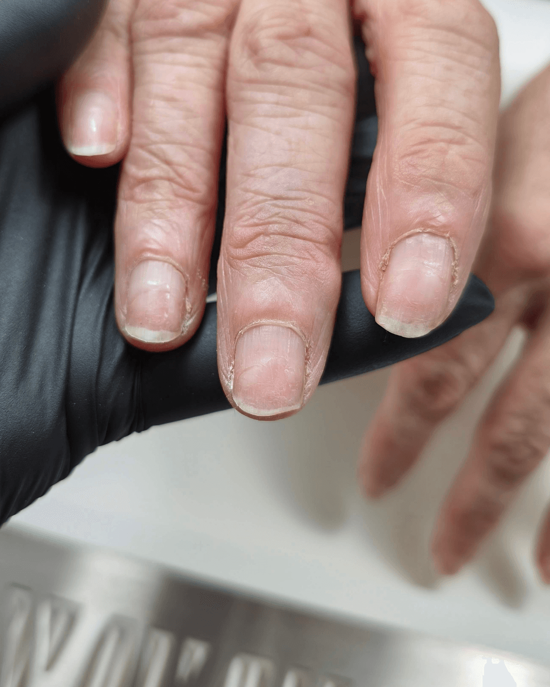 Before